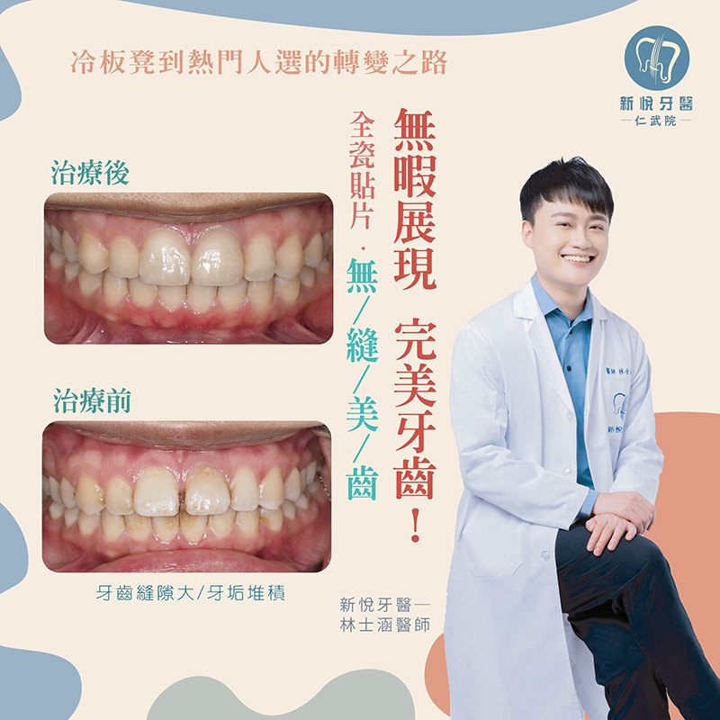 新悅美學牙醫診所的案例分享圖片